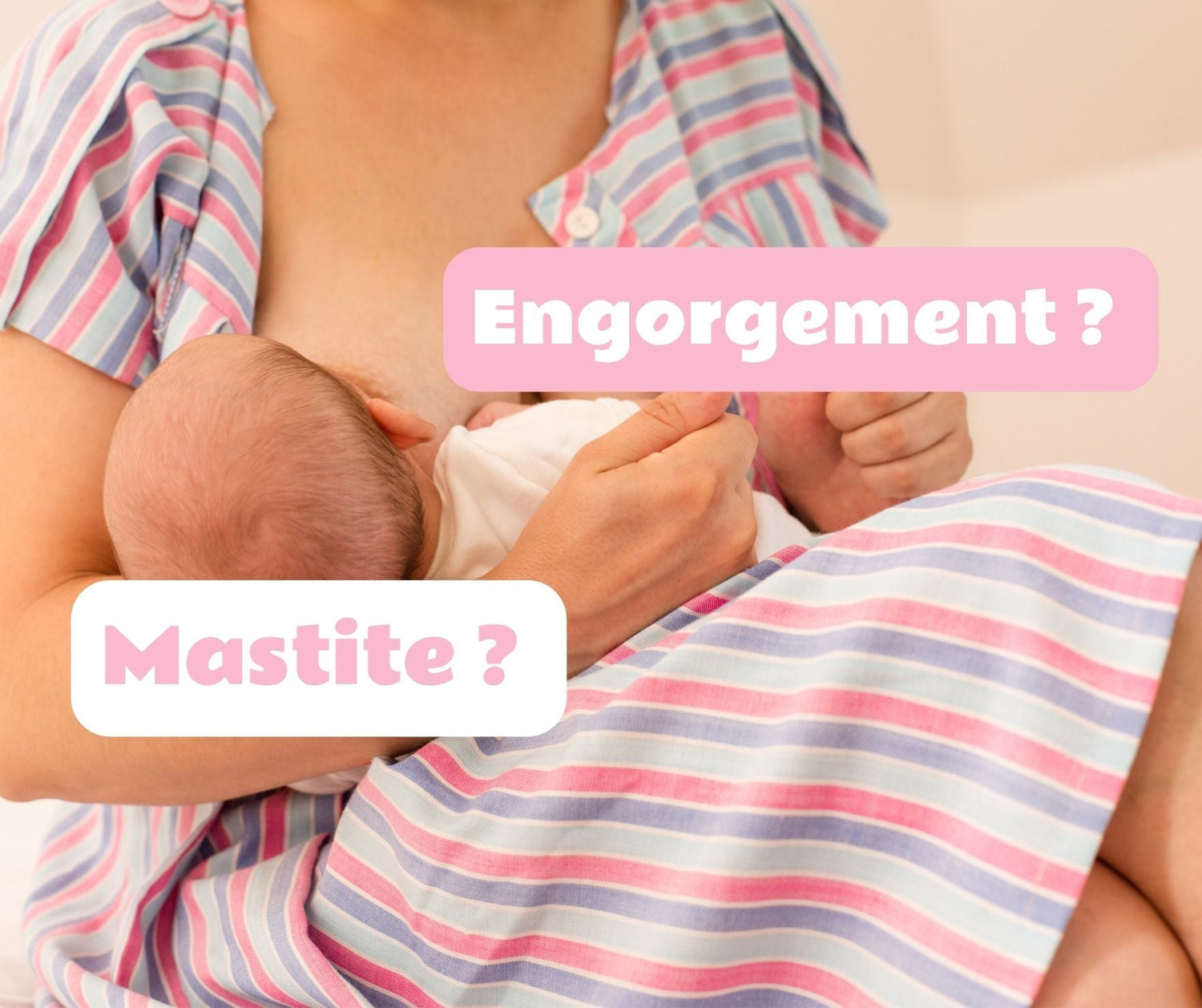 Engorgement et mastite : que faire pour les soulager